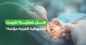 هل عملية تثبيت القرنية المخروطية مؤلمة؟ إليك كافة الحقائق والتفاصيل