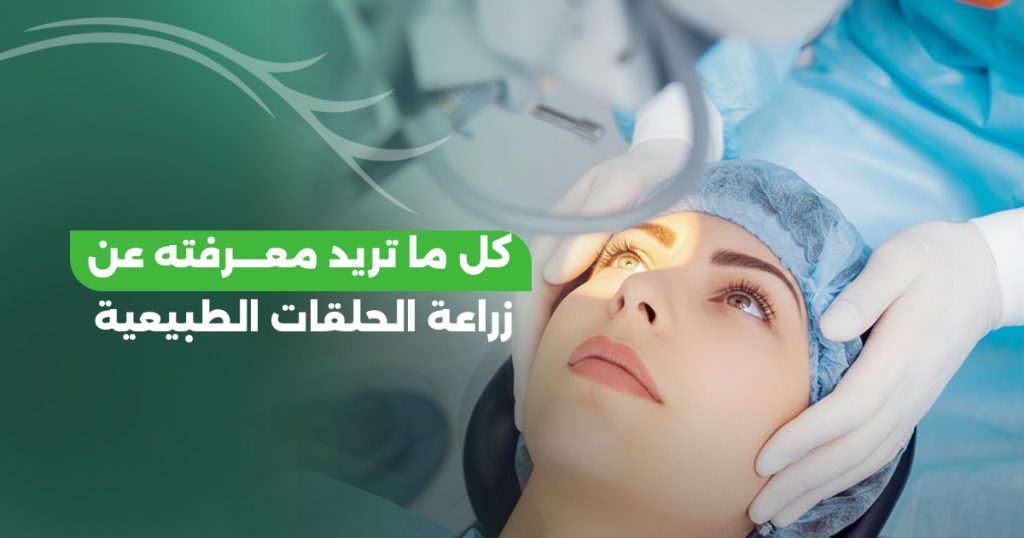 زراعة الحلقات الطبيعية (CAIRS): دليل الأمان والرؤية الأوضح