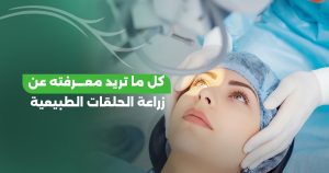 زراعة الحلقات الطبيعية (CAIRS): دليل الأمان والرؤية الأوضح