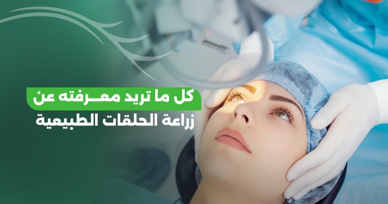 زراعة الحلقات الطبيعية (CAIRS): دليل الأمان والرؤية الأوضح