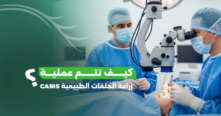 كيف تتم زراعة الحلقات الطبيعية CAIRS وما هي نسب نجاحها؟