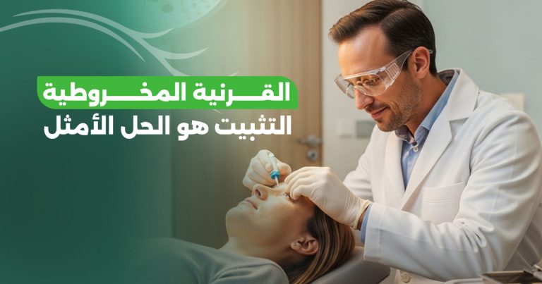 تثبيت القرنية المخروطية: لماذا تعتبر الحل الأمثل والوحيد؟